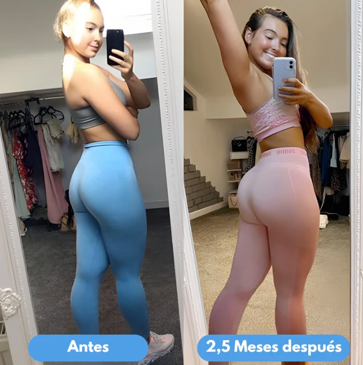 Kit Est. Gluteos, Abdomen y Brazos