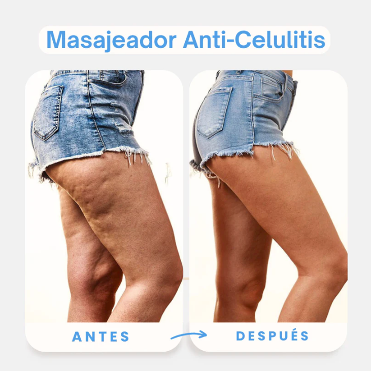 Masajeador Anti Celulitis